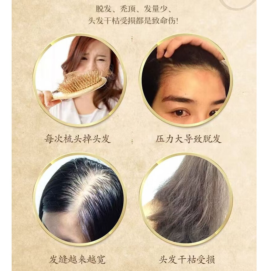 修正洗发水【脱发专研】滋养防脱固发洗发水脱发掉发断发男女用300ml 2瓶【滋养防脱固发洗发水】 300ml/瓶