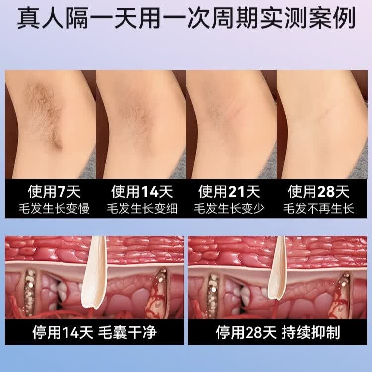 酷茵络腮胡专用男士大能量蓝宝石冰点脱毛仪脱胡须美容院同款家用持久 蓝宝石冰感proMax版【墨绿】