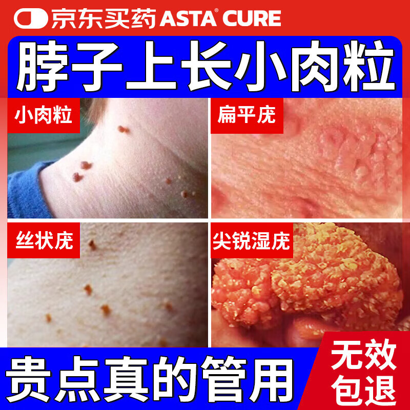 ���ڲ�����ASTACURE���������ȥ����콢��ҽ�ÿ���ȥ���ƽ��ר��ҩ100%��Чҩ10ml 179Ԫ