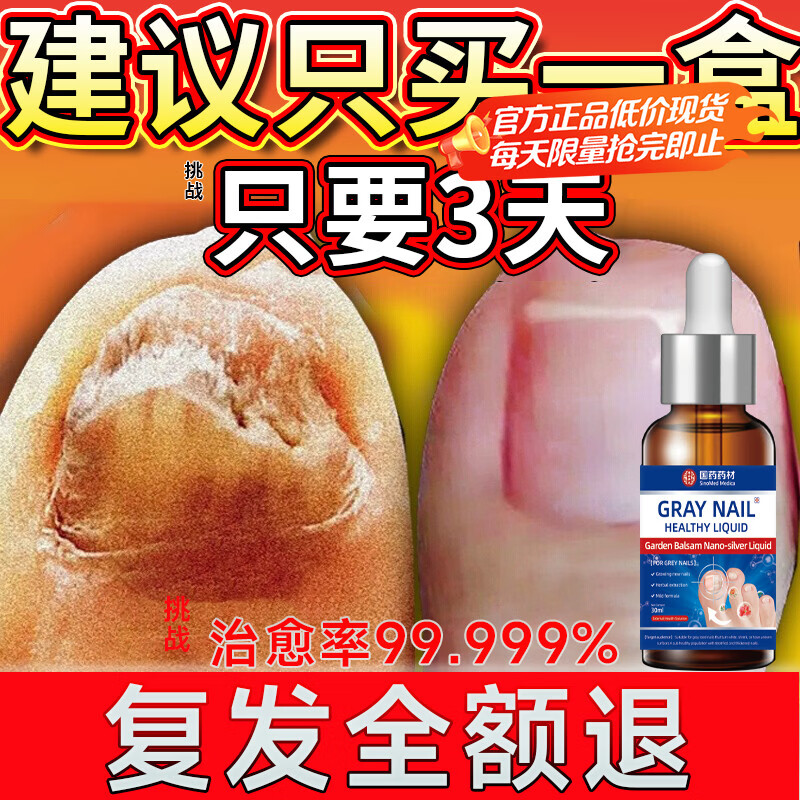 重度灰指甲100%特效专用的药特殊效专用抑菌液灰甲净套装 一盒【特效套装】1-2个灰甲选 灰指甲100%特效专用的药第一名