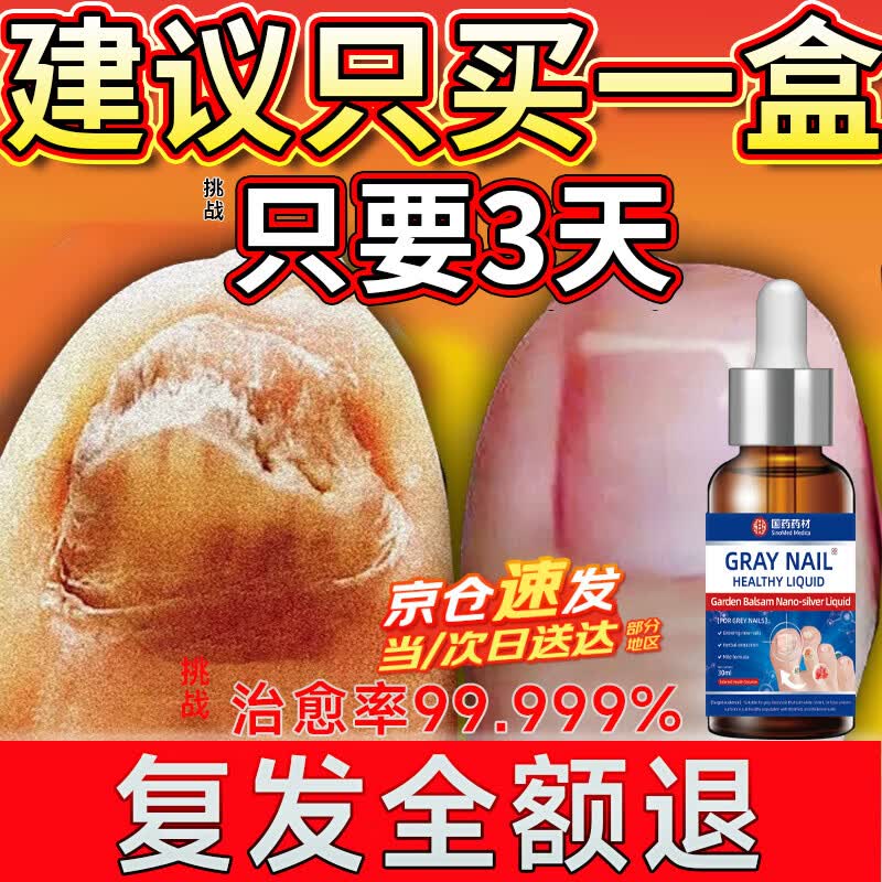 重度灰指甲100%特效专用的药特殊效专用抑菌液灰甲净套装 一盒【特效套装】1-2个灰甲选 灰指甲100%特效专用的药第一名