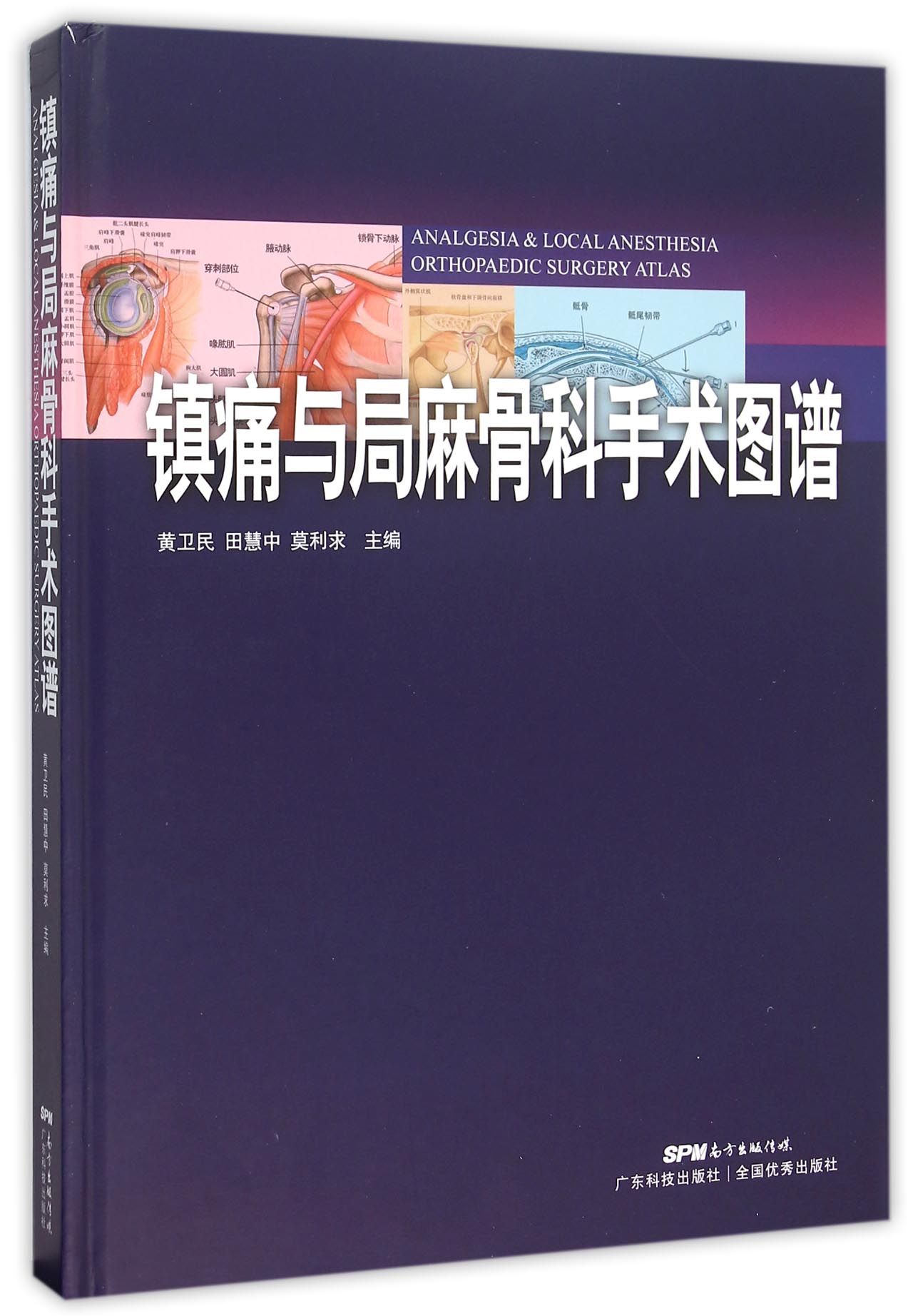 镇痛与局麻骨科手术图谱(精)