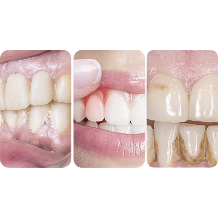 舒客牙刷护龈清洁  超软毛护龈小刷头成人牙刷  任选8件 柔丝护龈牙刷 2支