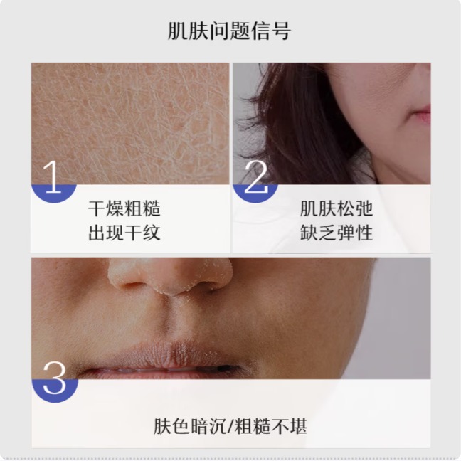 神琦北京301活性美容霜高保湿滋润面霜补水抗皱紧致修复护肤品140g/盒 白色