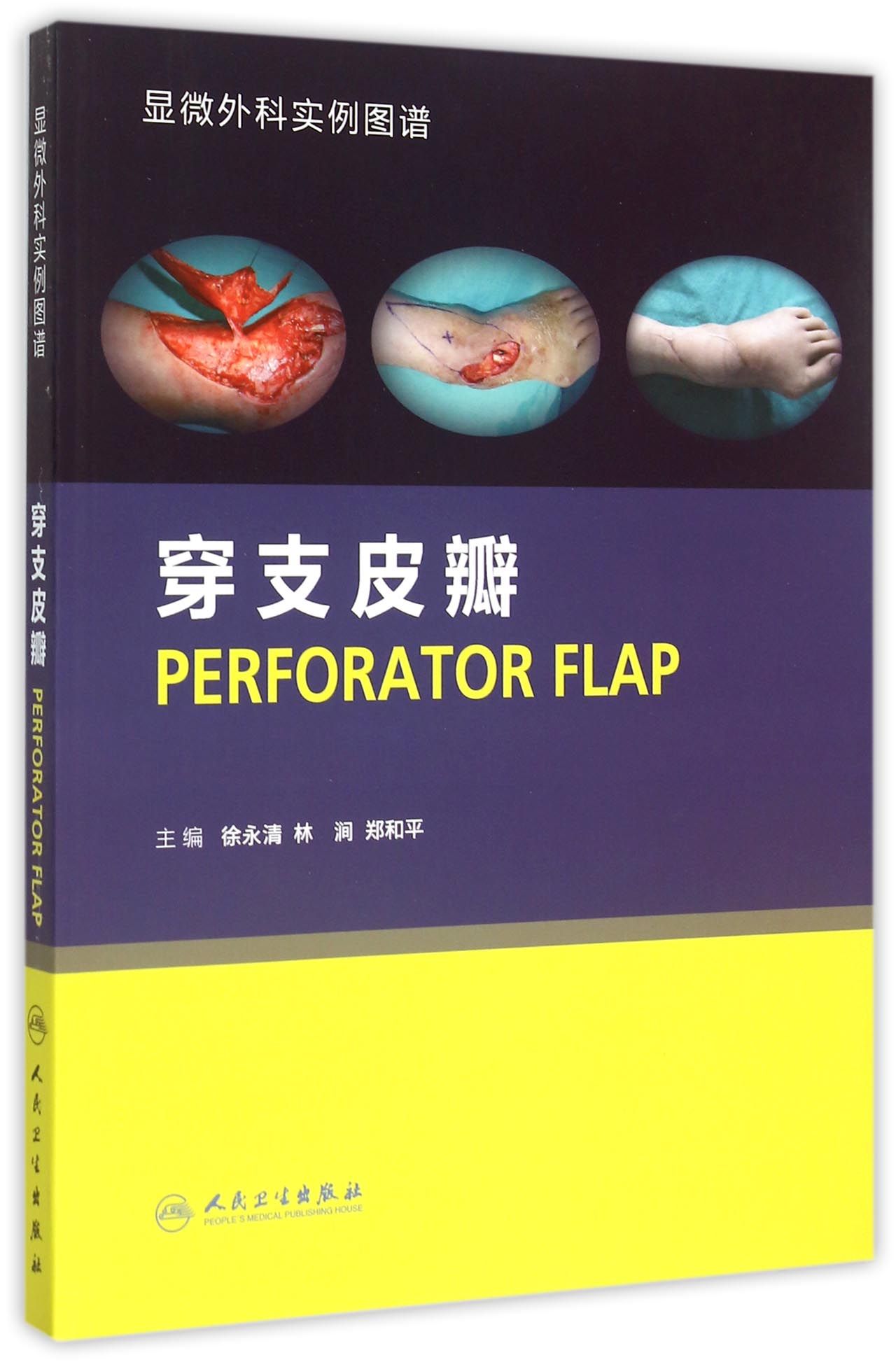 穿支皮瓣(显微外科实例图谱)