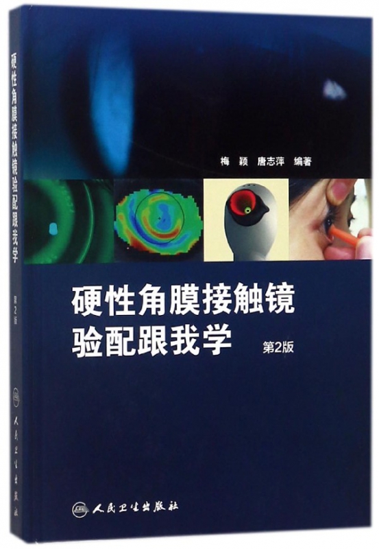 硬性角膜接触镜验配跟我学(第2版)(精)