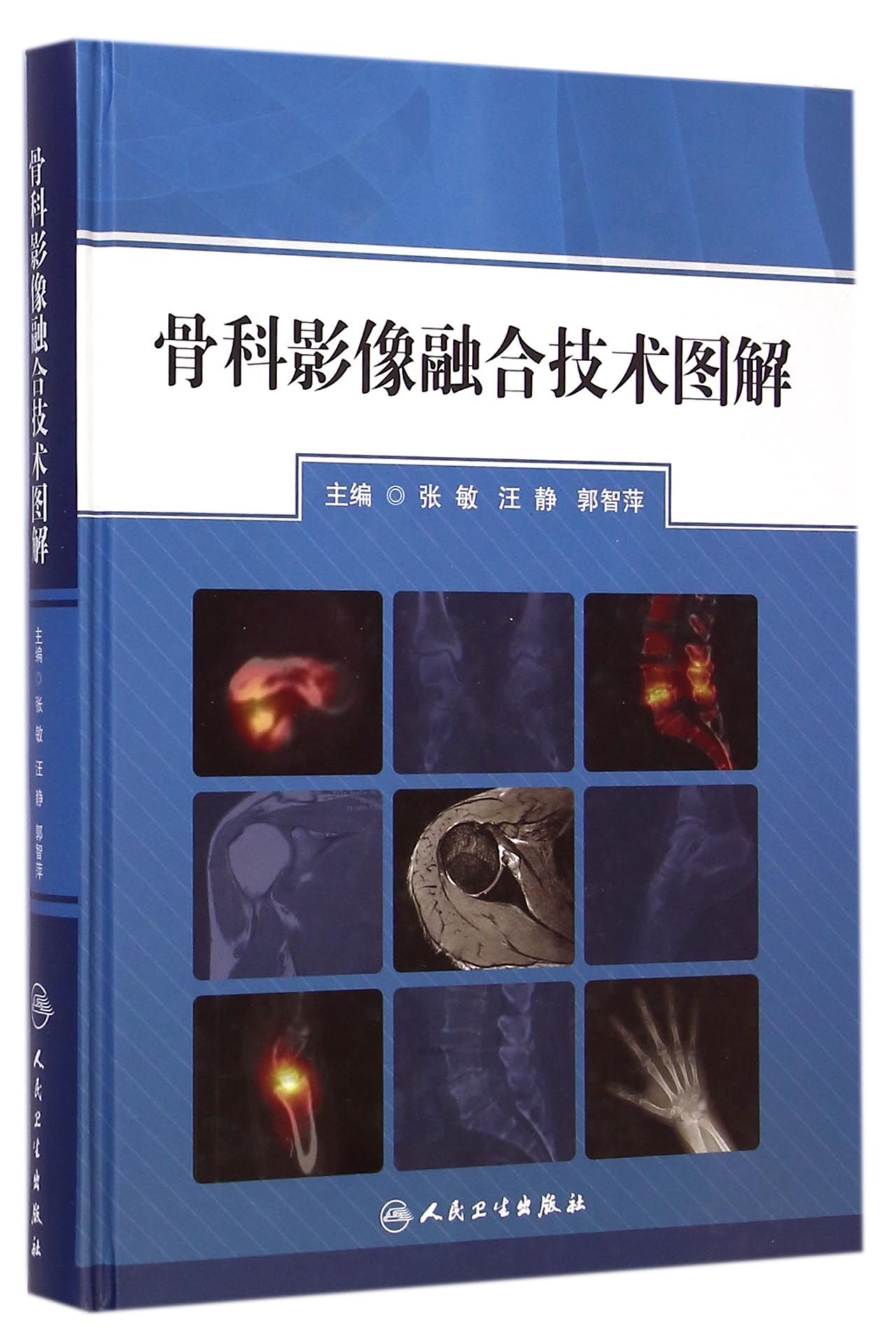骨科影像融合技术图解(精)