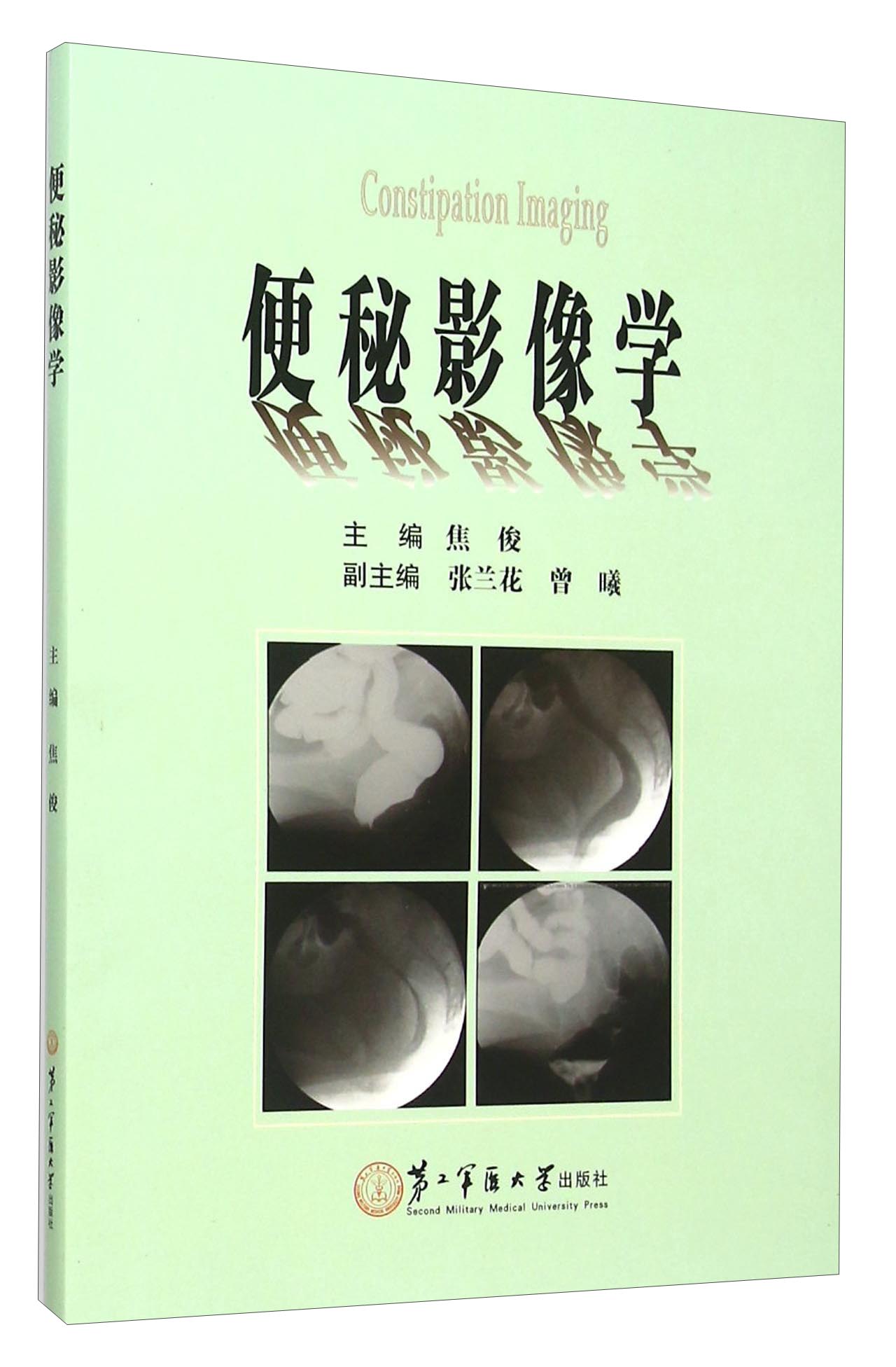 便秘影像学