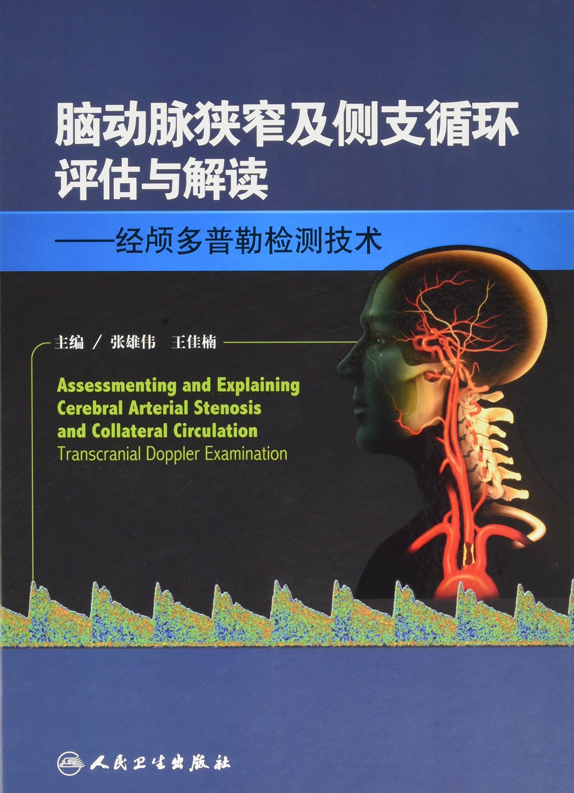 脑动脉狭窄及侧支循环评估与解读：经颅多普勒检测技术