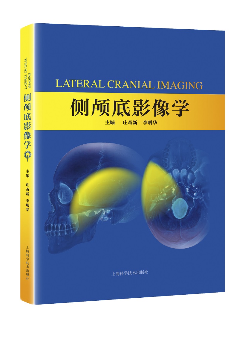 侧颅底影像学