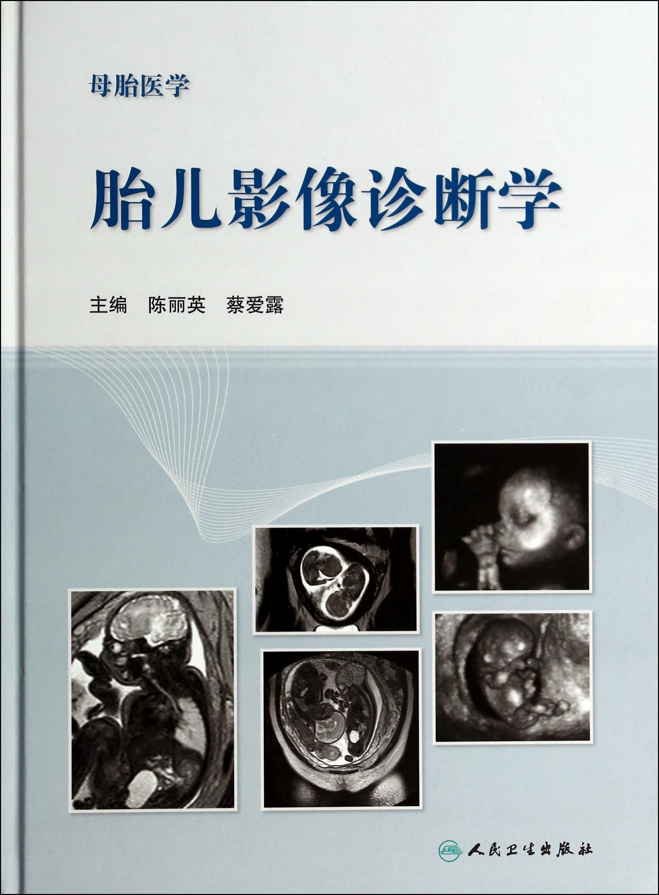 胎儿影像诊断学(母胎医学)(精)