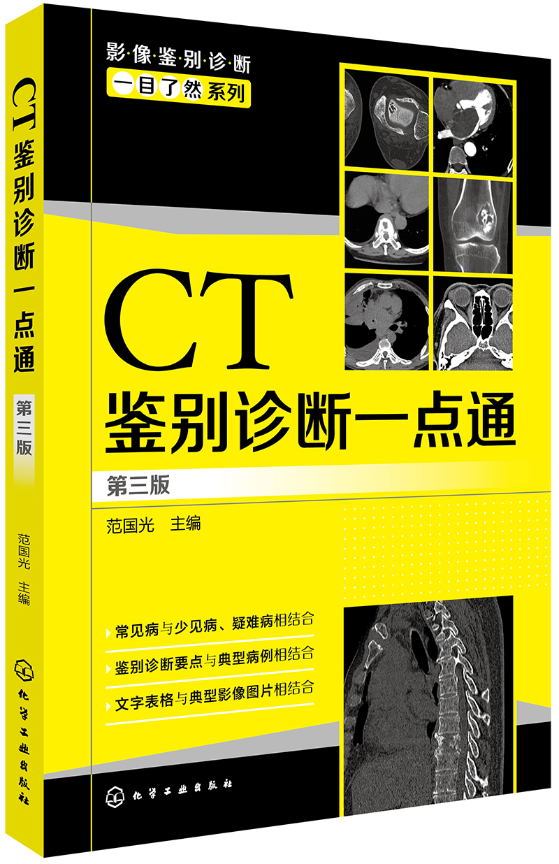 影像鉴别诊断一目了然系列--CT鉴别诊断一点通（第三版）