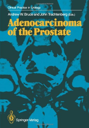 Adenocarcinoma of the Prostate