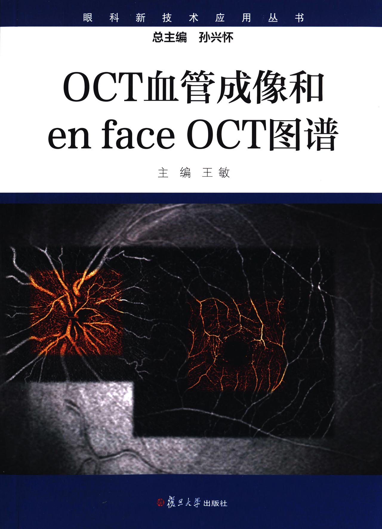 眼科新技术应用丛书:oct血管成像和enface oct图谱(平装版)