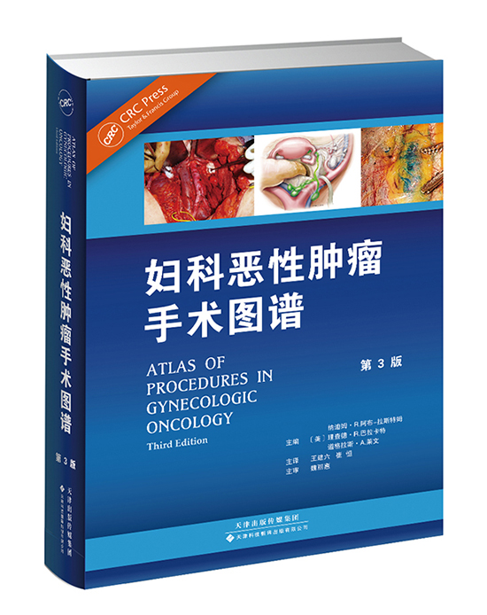妇科恶性肿瘤手术图谱
