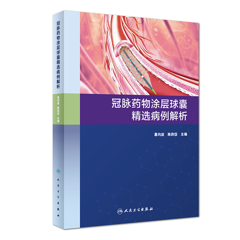 冠脉药物涂层球囊精选病例解析