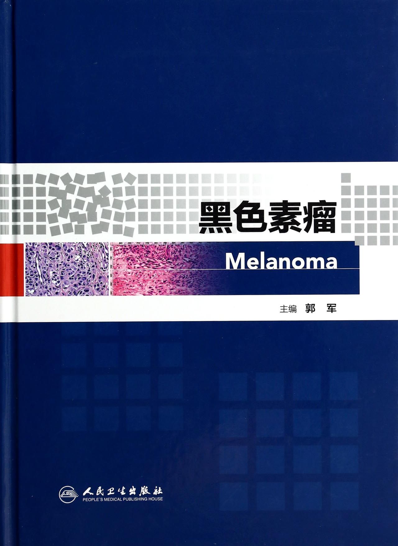 黑色素瘤(精)