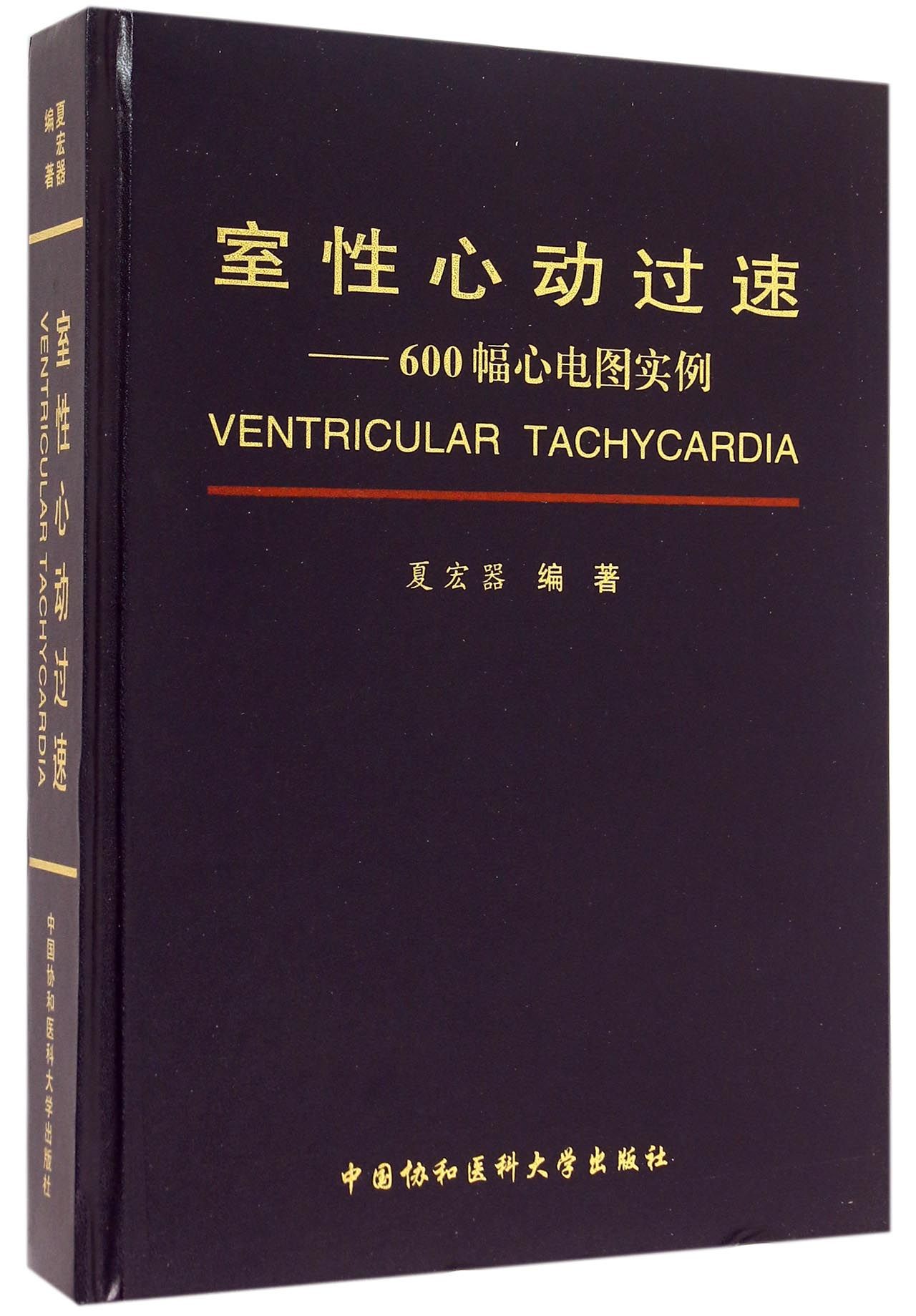 室性心动过速--600幅心电图实例(精)
