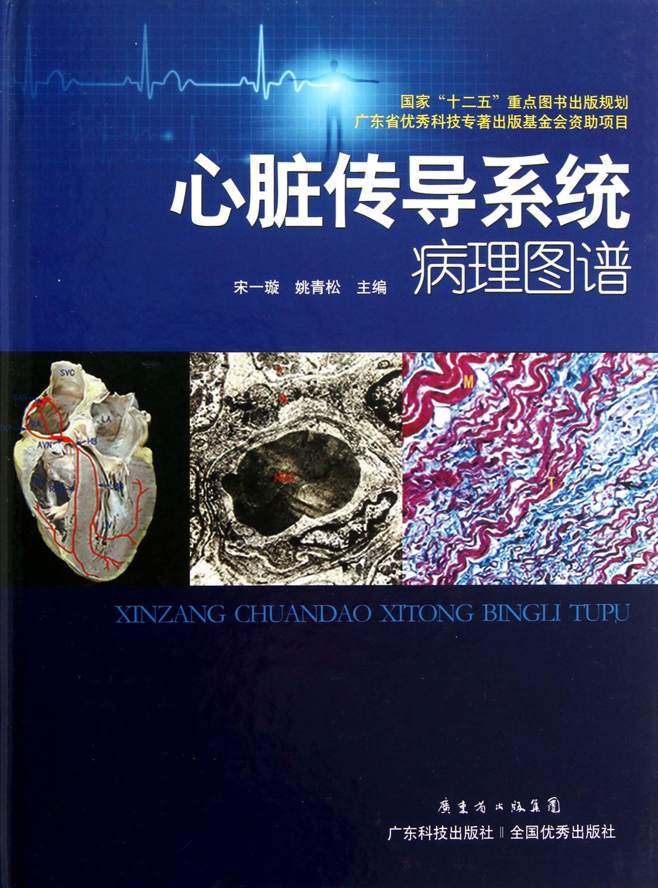 心脏传导系统病理图谱(精)