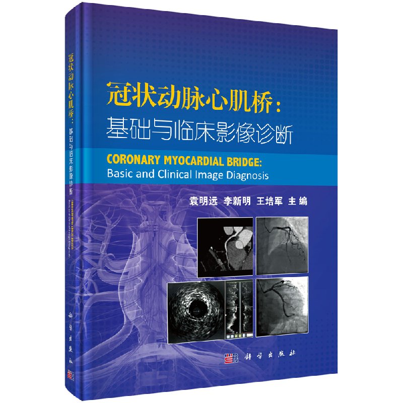 冠状动脉心肌桥：基础与临床影像诊断