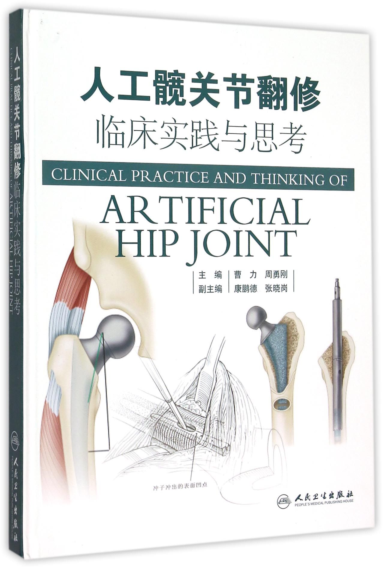 人工髋关节翻修临床实践与思考(精)