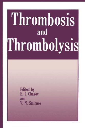【预订】thrombosis and thrombolysis