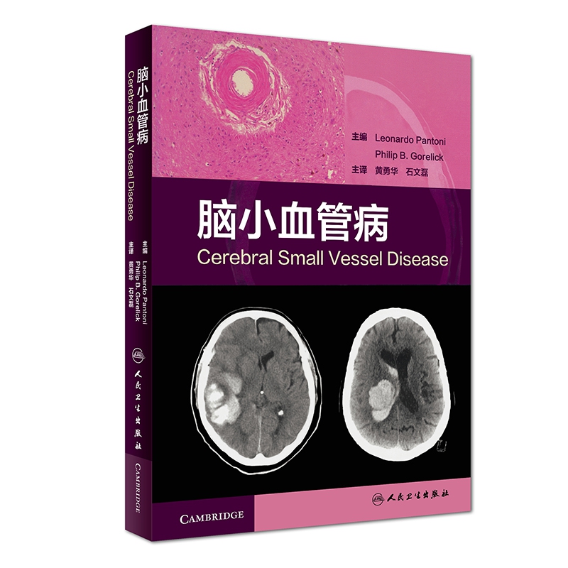 脑小血管病