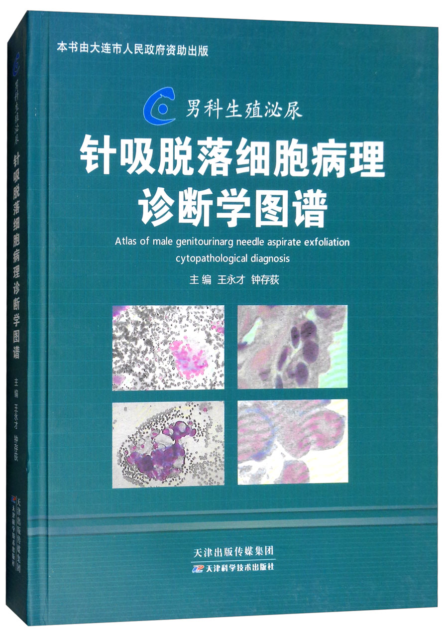 男科生殖秘尿针吸脱落细胞病理学诊断图谱