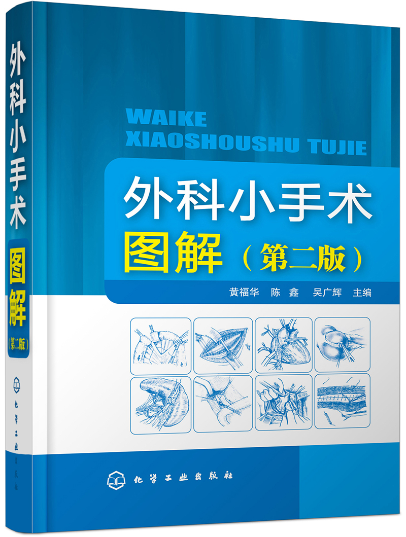 外科小手术图解(第二版)