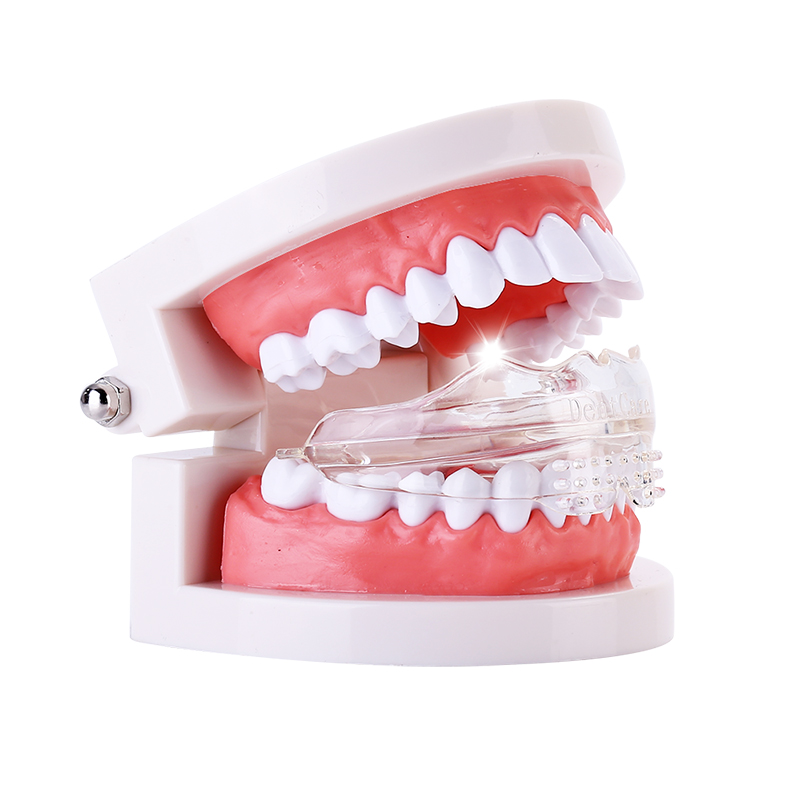 「快速直达」爱牙牙4D牙齿矫正 成人隐形牙套矫正 夜间矫正牙齿不整齐龅牙地包天 保持器 磨牙套 「95%的用户都选择了它」D1前期矫正牙套