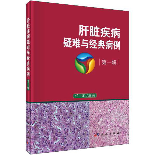 肝脏疾病疑难与经典病例 第一辑