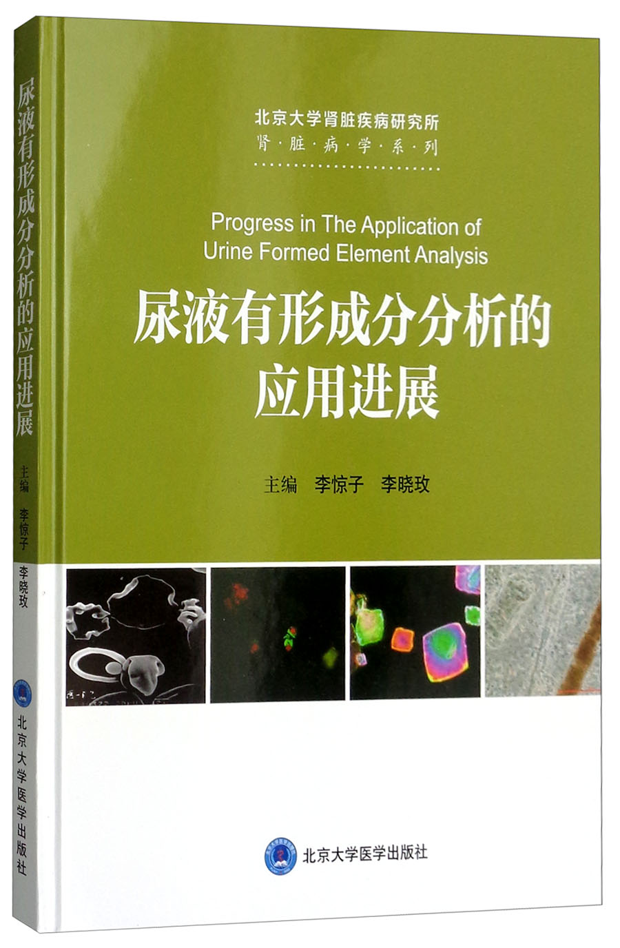 尿液有形成分分析的应用进展