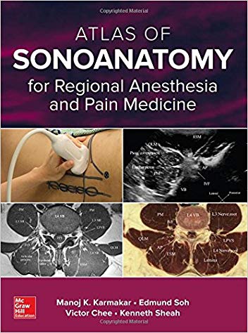 ATLAS OF SONOANATOMY 4 REGIONAL ANESTHES