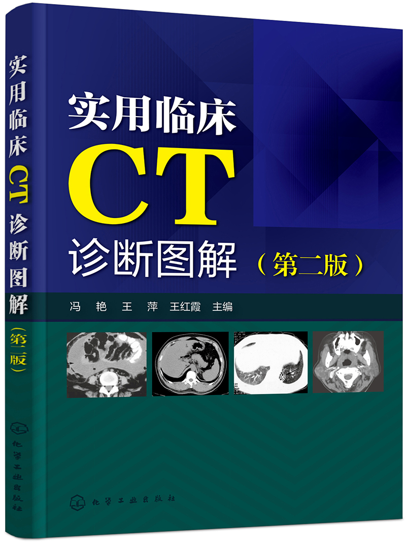 实用临床CT诊断图解（第二版）
