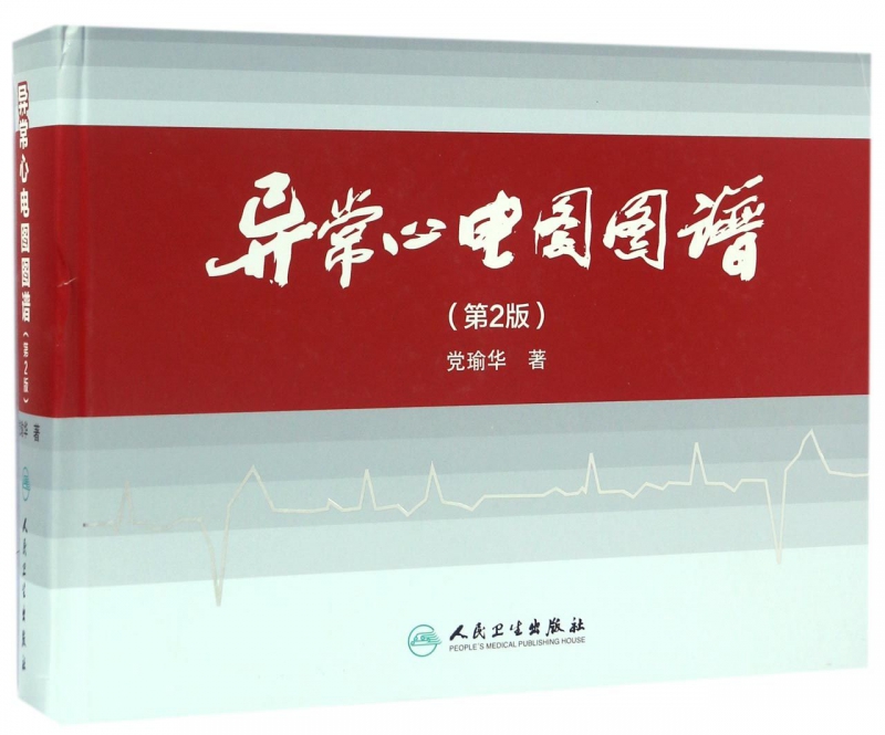 异常心电图图谱(第2版)(精)