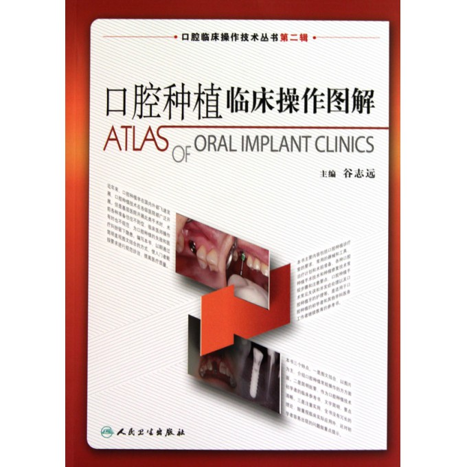 口腔种植临床操作图解/口腔临床操作技术丛书