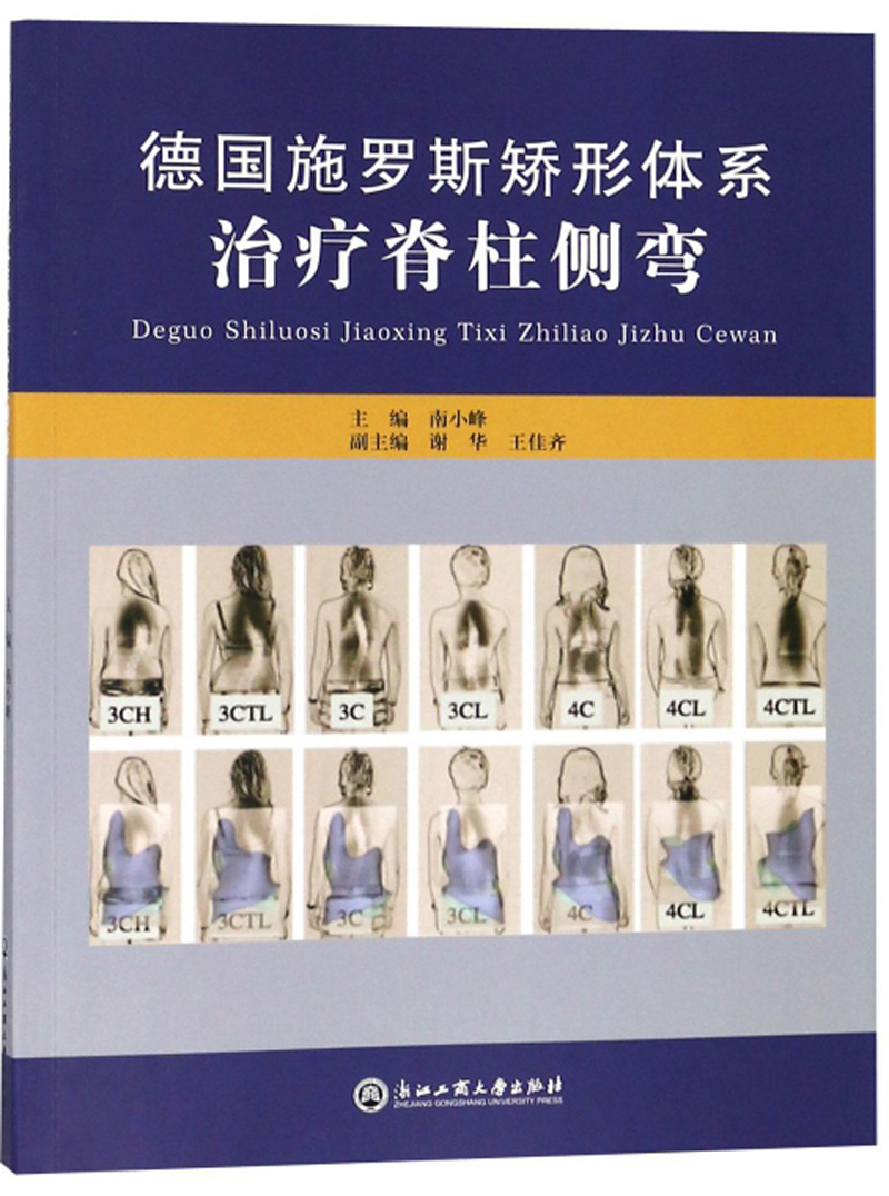 德国施罗斯矫形体系治疗脊柱侧弯 9787517816928