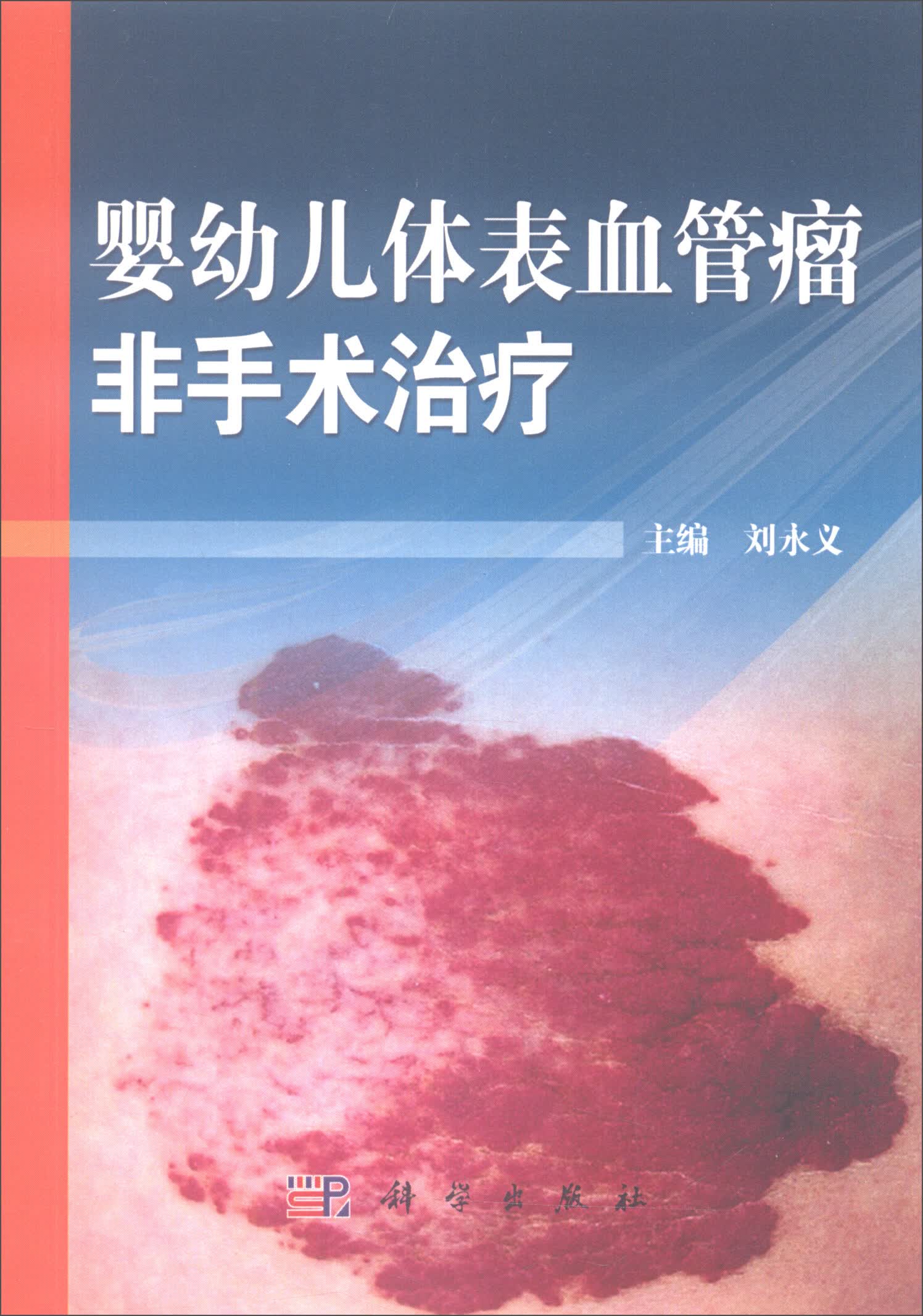 婴幼儿体表血管瘤非手术治疗