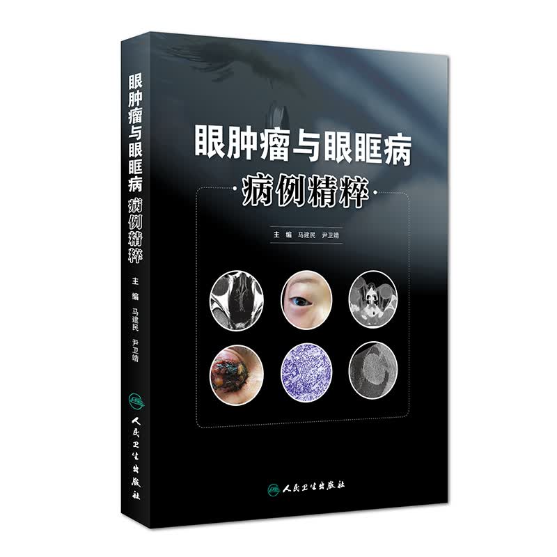 眼肿瘤与眼眶病病例精粹