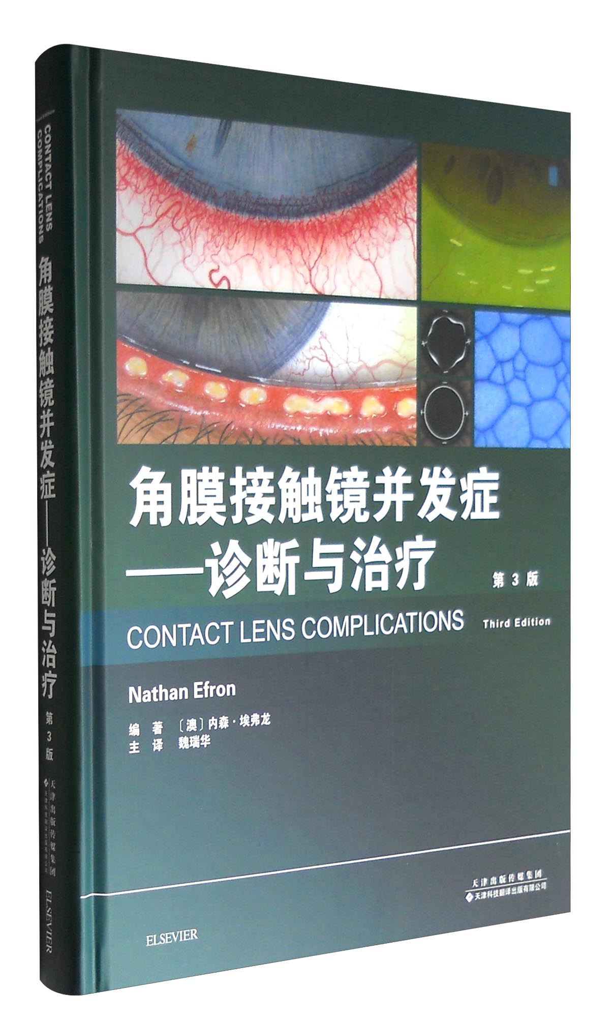角膜接触镜并发症：诊断与治疗（第3版）