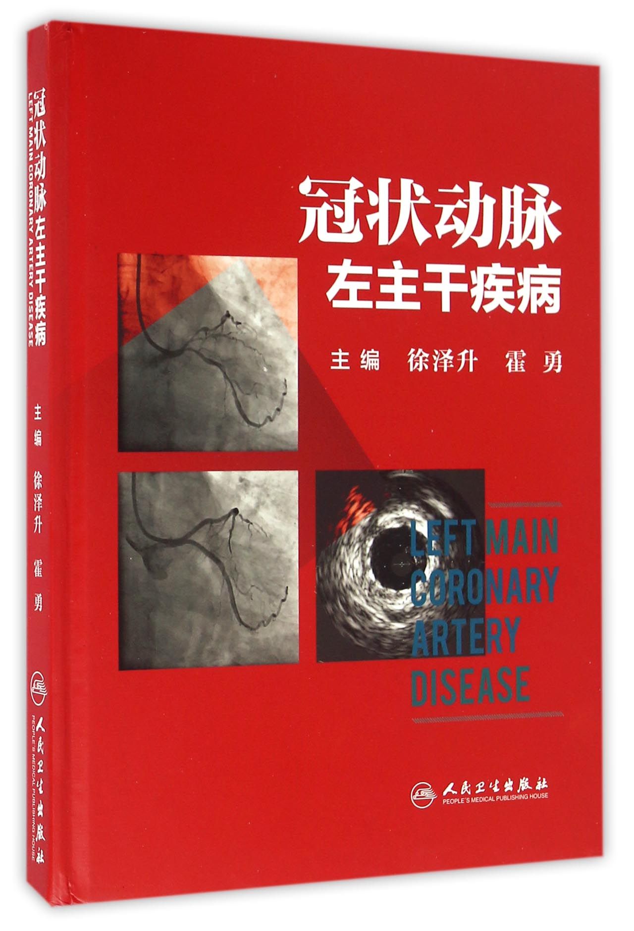 动脉左主干疾病配盘