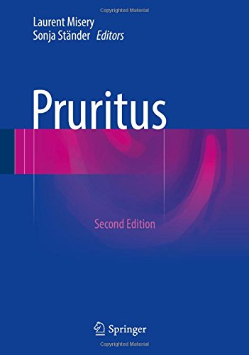 【预订】pruritus