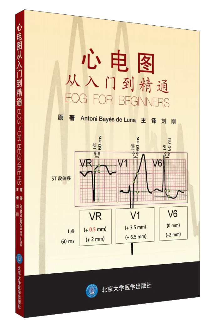 心电图从入门到精通