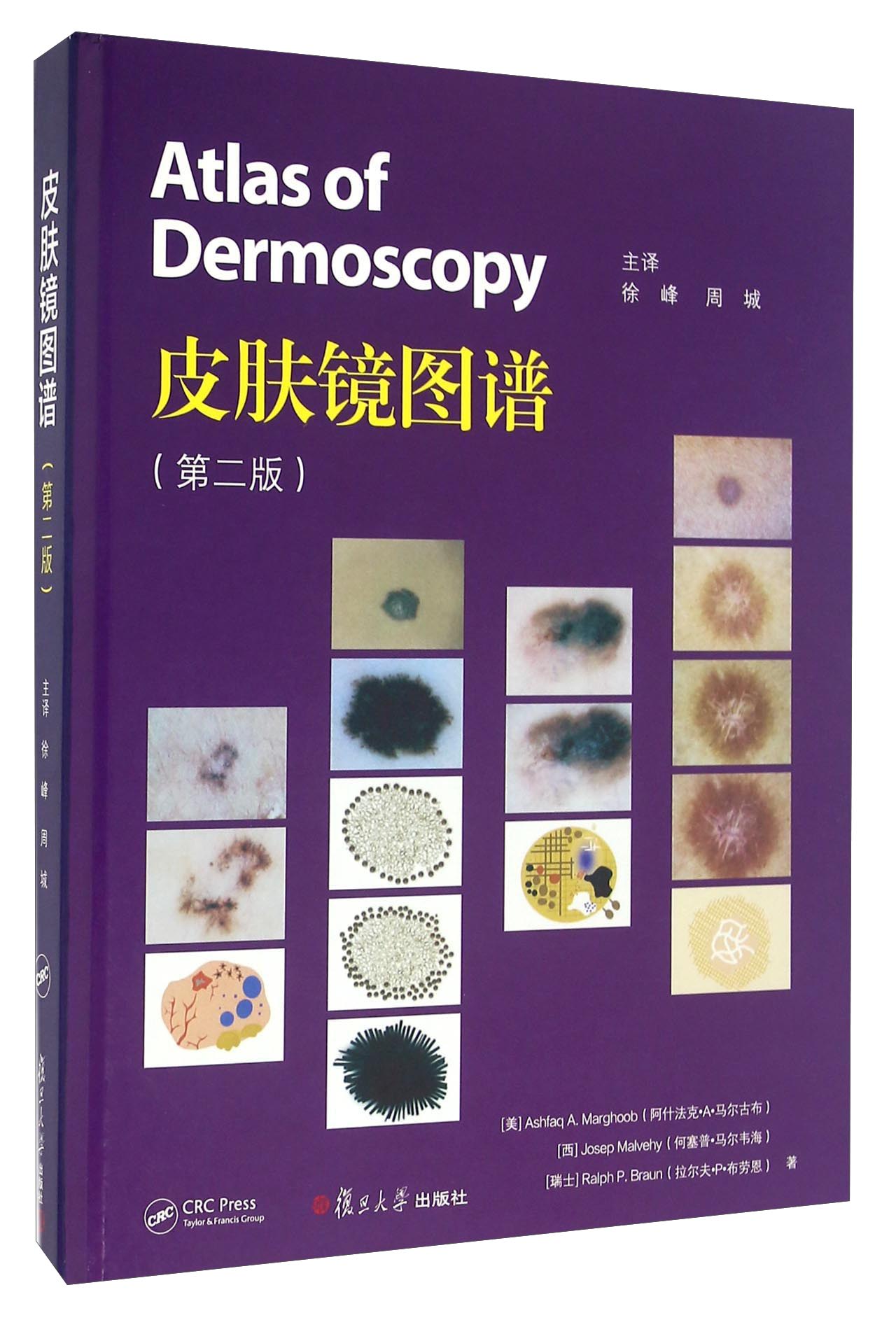 皮肤镜图谱第二版