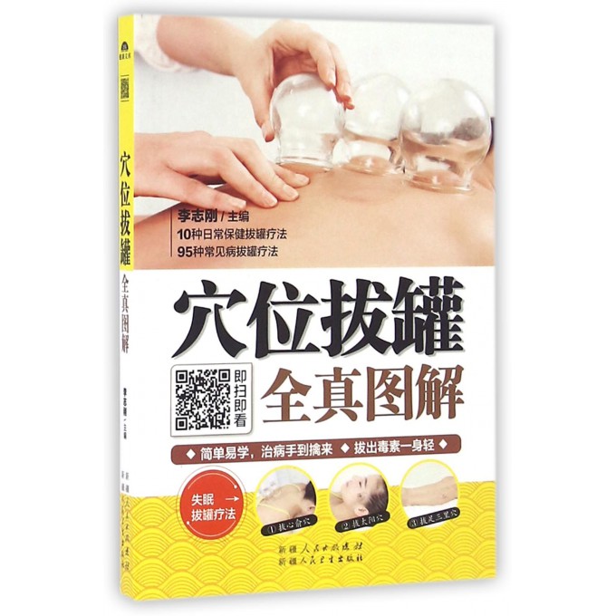 穴位拔罐全真图解