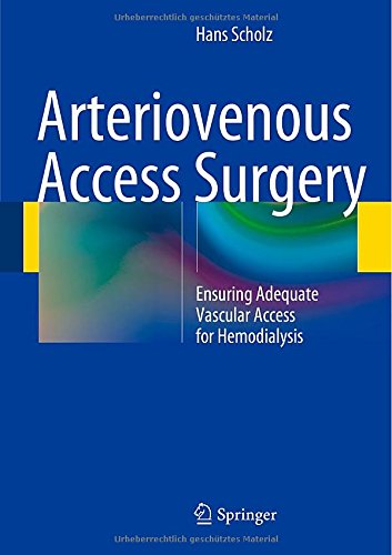 【预订】arteriovenous access surgery