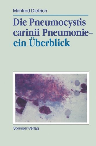【预订】die pneumocystis carinii pneumonie ein