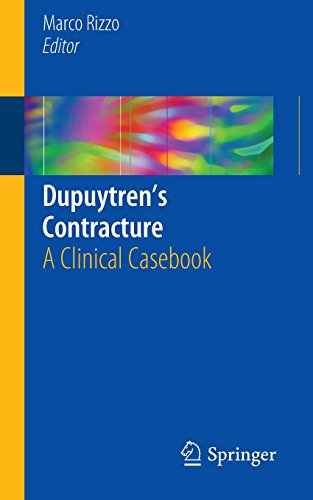 【预订】dupuytren s contracture: a clinical