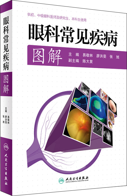眼科常见疾病图解