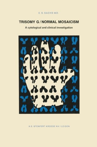 【预订】trisomy g normal mosaicism: a